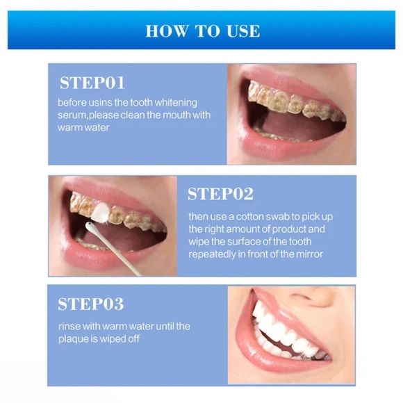 Teeth whitening portable whitening  pen guaranteed whitening in less than a week - Picture 8 of 10